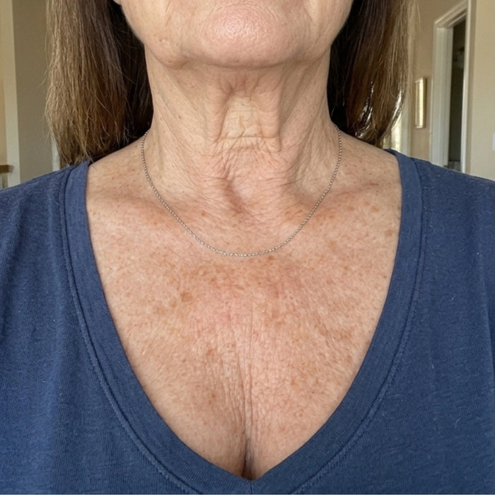 Neck and chest before using the body oil