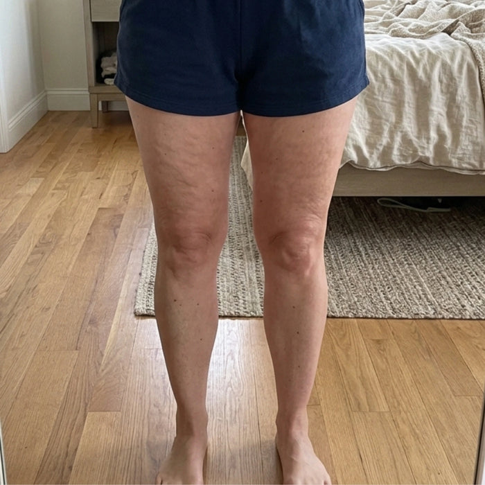 Thighs and legs before using the body oil