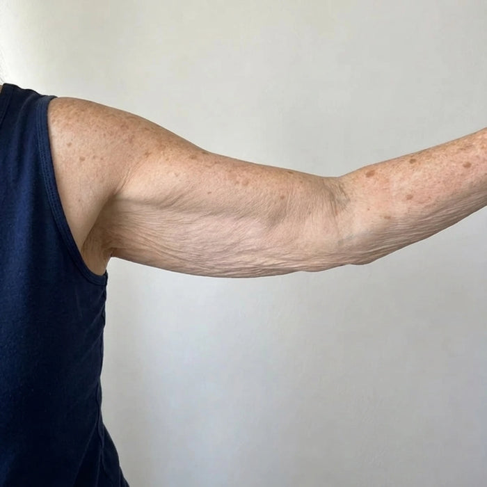 Upper arm before using the body oil